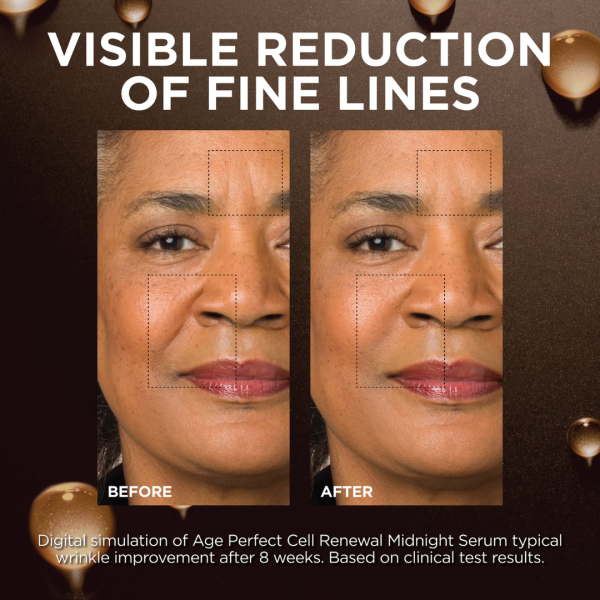 L’oreal L'Oreal Paris Age Perfect Cell Renewal Midnight Serum - Image 10