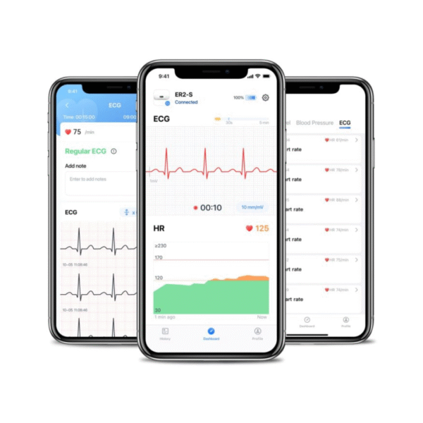 DuoEK-S Personal ECG Monitor, Bluetooth Wireless Portable Heart Monitor - Image 4